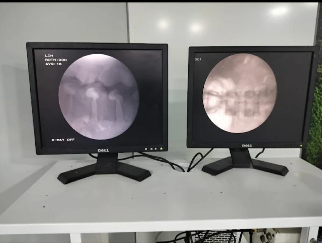 C-arm machine preview